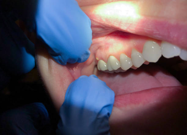 Best Broken Tooth Emergency  in Crowley, LA