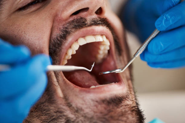 Best Emergency Gum Pain Relief  in Crowley, LA
