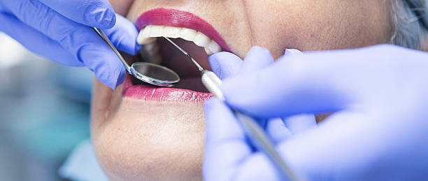 Best Chipped Tooth Repair Near Me  in Crowley, LA